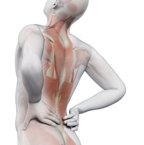 Mann mit akuten Rückenschmerzen – Schematische Darstellung der Rückenmuskulatur. Paraxis Dr. med Angela Vogel hilft gegen Rückenschmerzen.